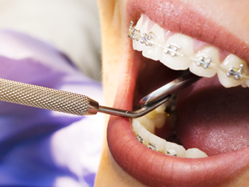 orthodontics
