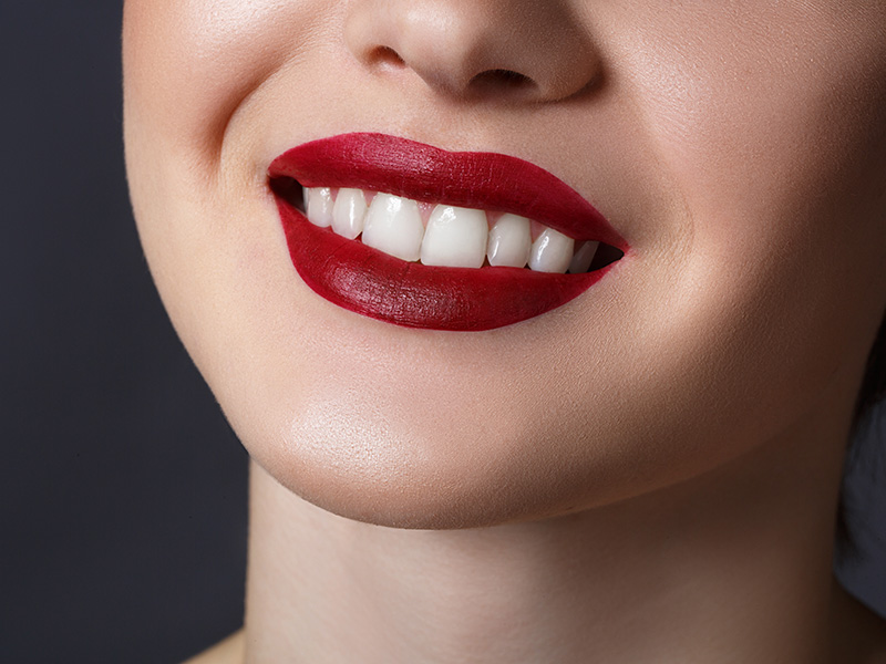Advantages & Disadvantages of veneers Dentist Werribee